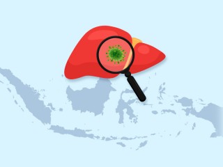 Kasus Hepatits Akut di Indonesia Bertambah